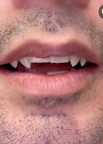 Vampir diş 1 çift - Görsel 8