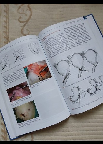 Mide Kanserine Minimal İnvaziv Yaklaşım Kitabı - Görsel 2