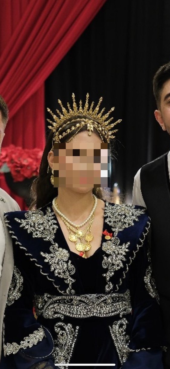 KINA TACI SALLANTILI ALINLIK - Görsel 2