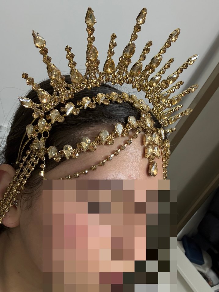 KINA TACI SALLANTILI ALINLIK - Görsel 4