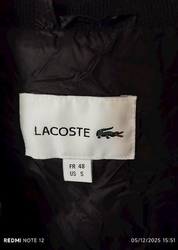 Düğmeli Siyah Rahat Erkek Mont - Görsel 3