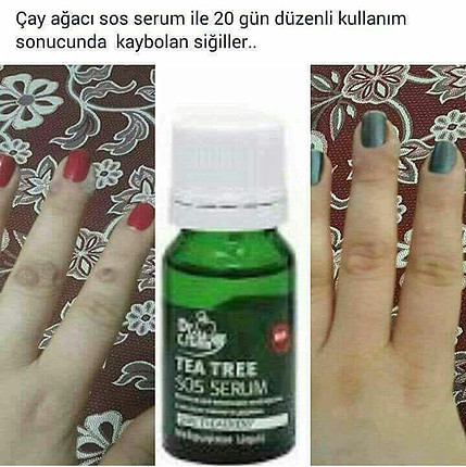 Kisiye ozel