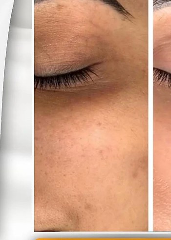 Koreasın Cilt Bakım Kremi - Görsel 3