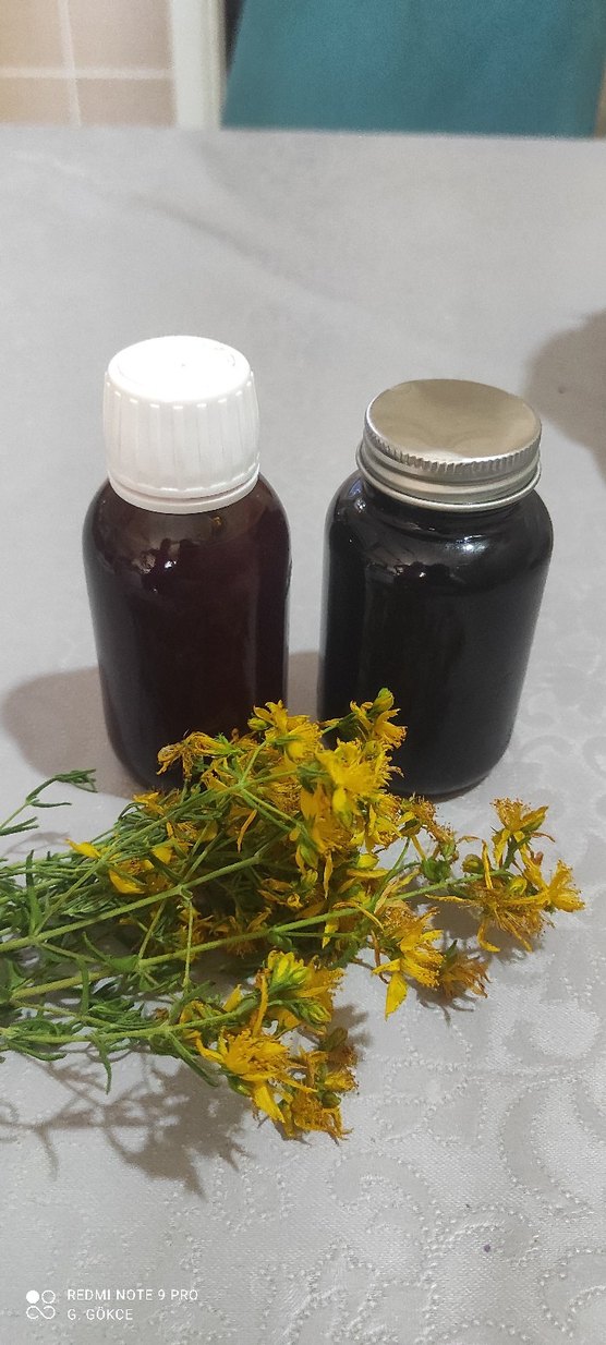 Kantoron yağı - Görsel 2