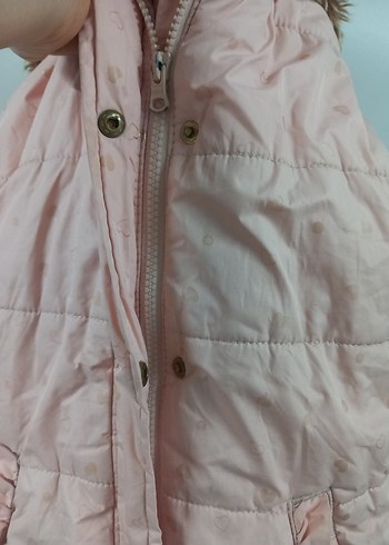 Kız Çocuk Pembe Kapşonlu Düğmeli Yelek - Görsel 5