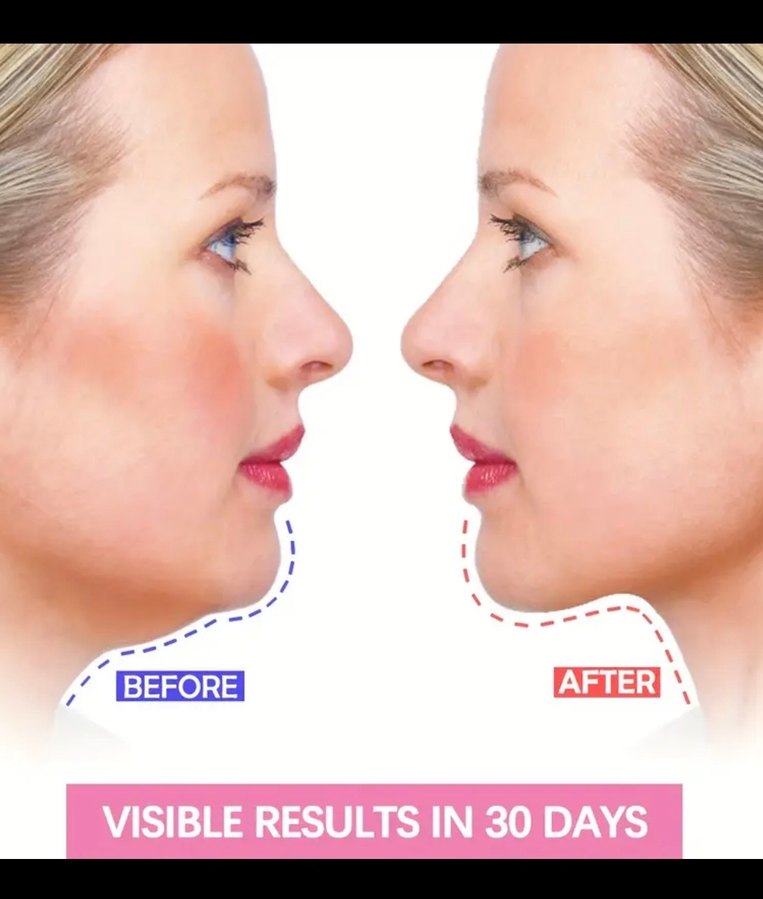 V-Line Yüz Sekillendirme Germe Maskesi - Görsel 2