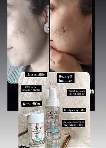 Dr.Clinic Prebiyotik Set 