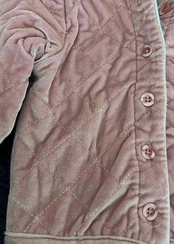 Düğmeli Pembe Kız bebek ceket - Görsel 2
