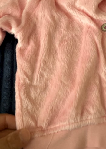 Düğmeli Pembe Kız bebek yelek - Görsel 4