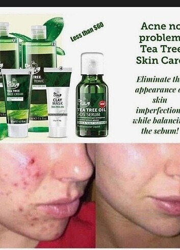 Sivilce kurutucu serum