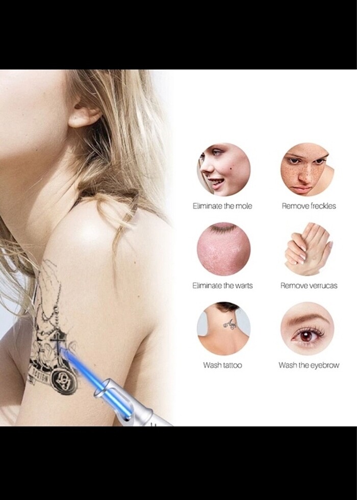 Netacell mavi lazer kalemi pikosecond - Görsel 3