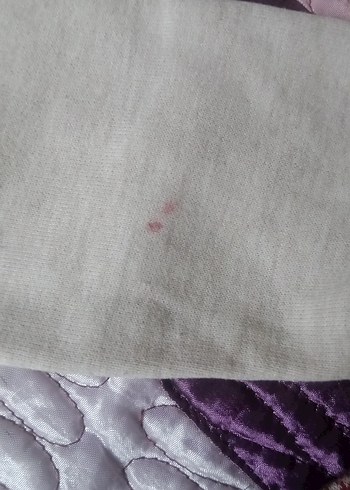 24-36 ay Düğme detayli beli lastikli Pembe kız Bebek Takımı - Görsel 5