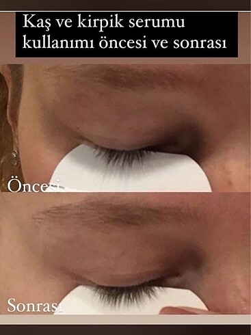 Farmasi Kaş köpük serumu