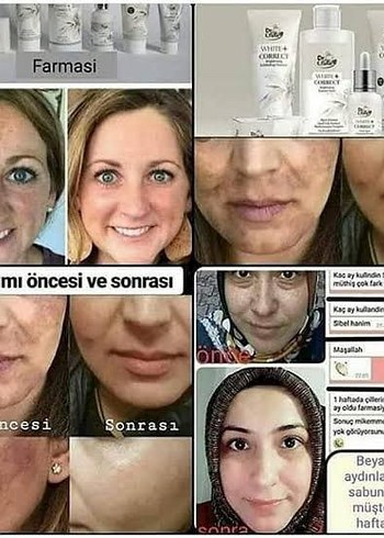 Cilt Aydınlatıcı Krem Öncesi ve Sonrası - Görsel 3