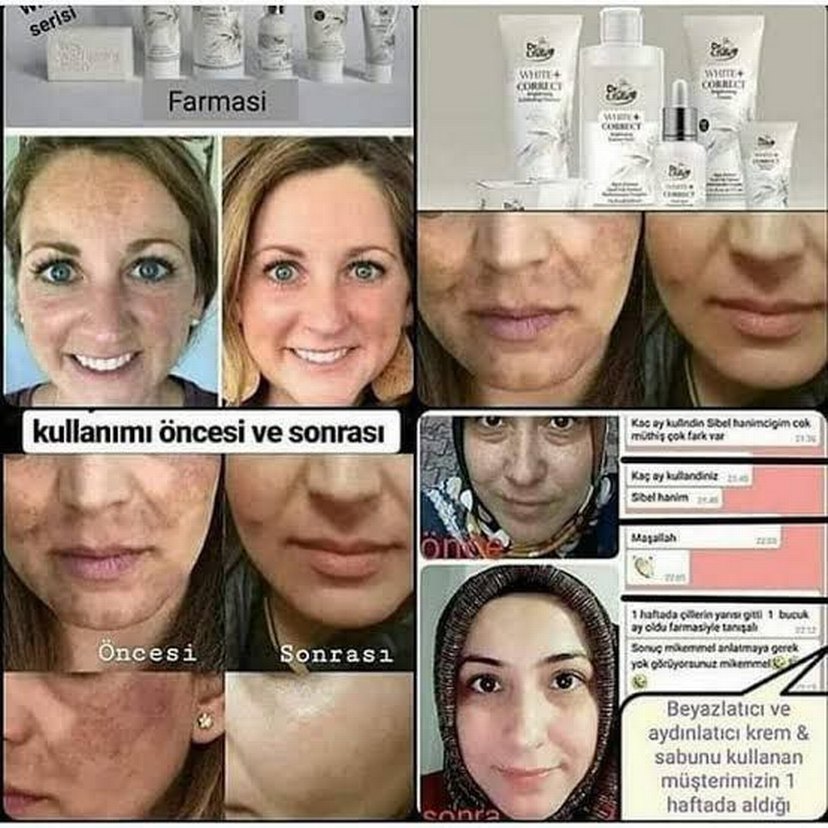 Cilt Aydınlatıcı Krem Öncesi ve Sonrası - Görsel 3