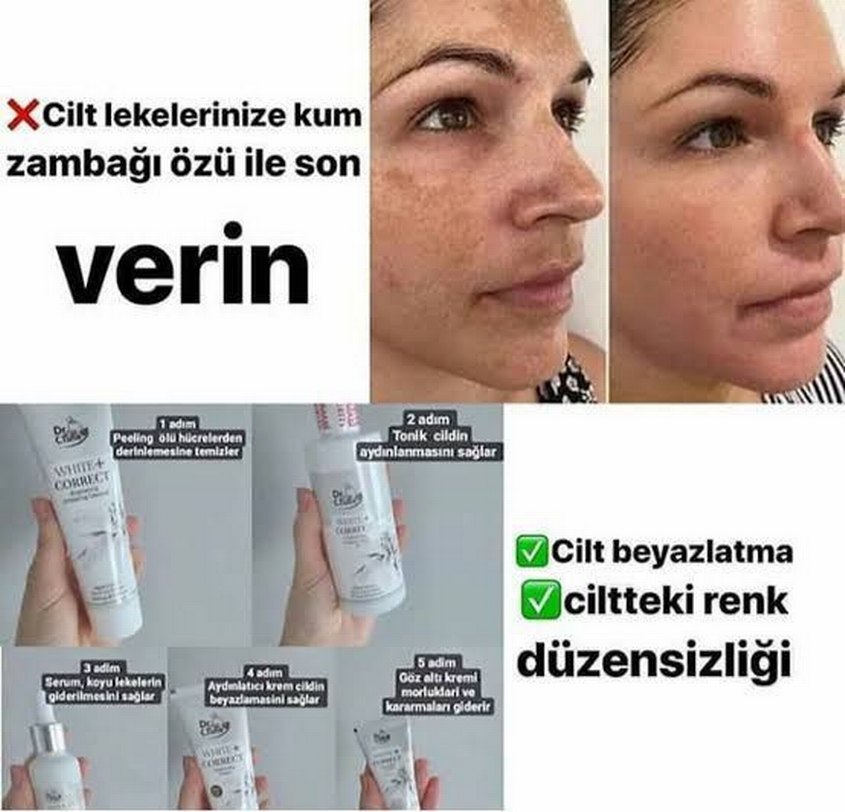 Cilt Aydınlatıcı Krem Öncesi ve Sonrası - Görsel 2