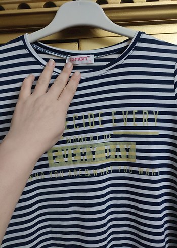 Altın Renkli Çizgili Hamile Elbisesi - Görsel 3