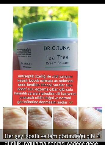 Çay ağacı balsam 