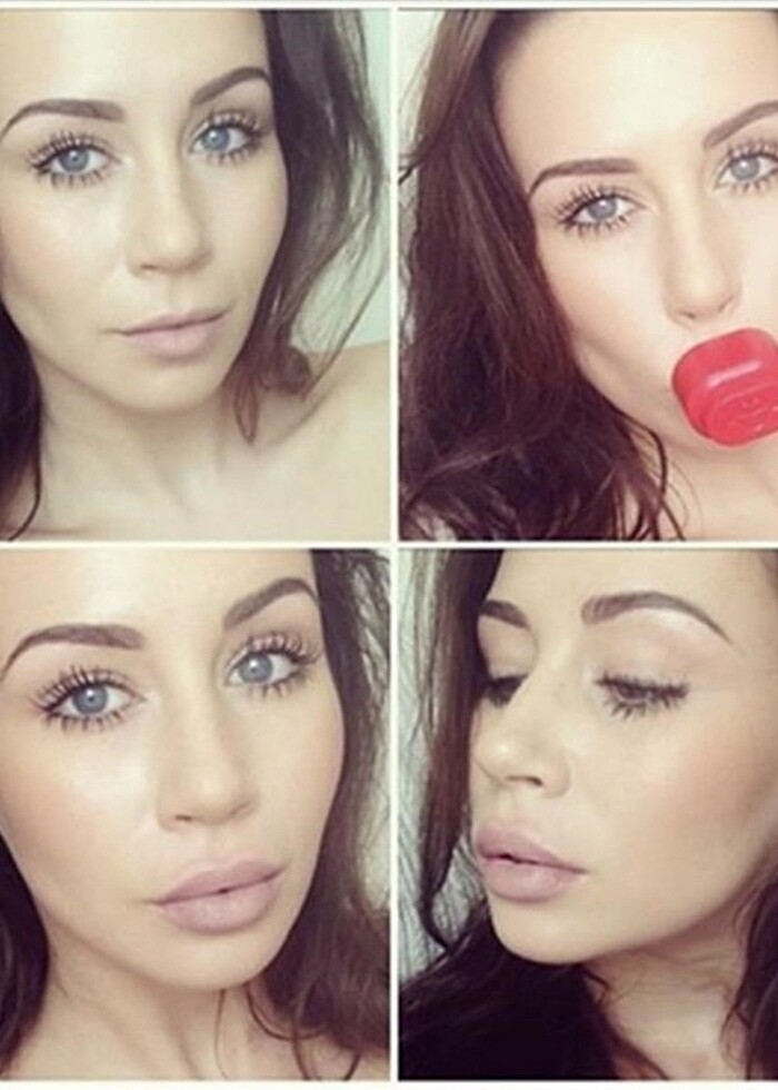 Dudak dolgunlaştırıcı aparat  - Görsel 2