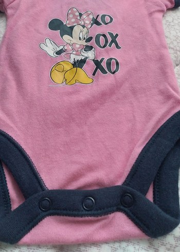 Pembe Baskılı Çocuk bady - Görsel 5