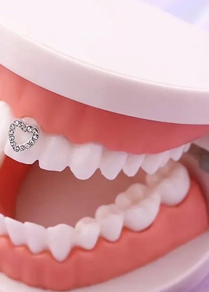 Diş taşı - Görsel 5