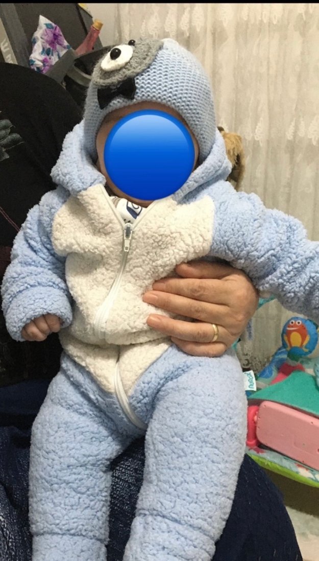 Mavi Kürklü Bebek Tulumu - Görsel 3