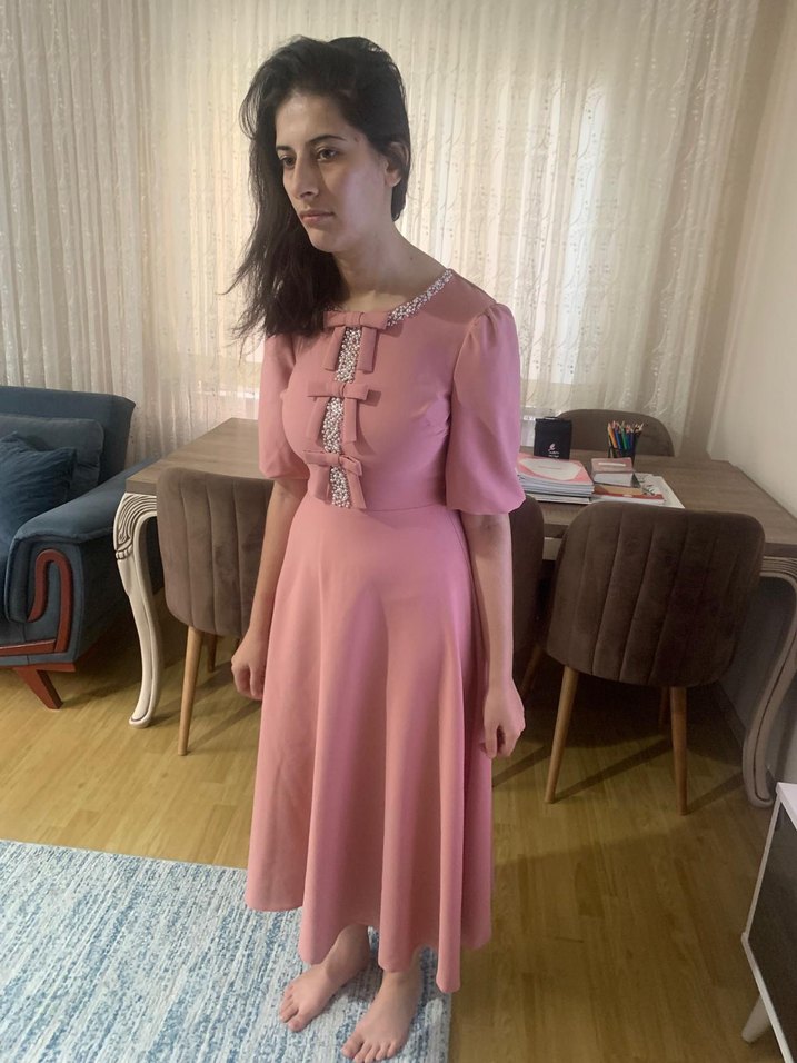 Pembe Vintage Midi Elbise - Görsel 4