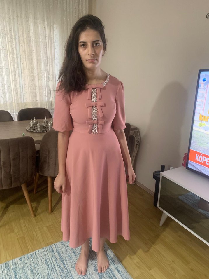 Pembe Vintage Midi Elbise - Görsel 3