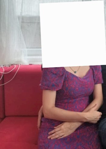 Mor desenli yırtmaçlı elbise - Görsel 7