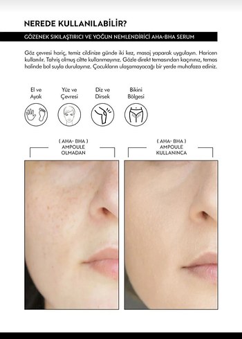 KOREACO Siyah Nokta ve Akne Karşıtı Ampul 50ml - Görsel 5