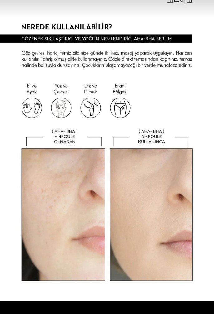 KOREACO Siyah Nokta ve Akne Karşıtı Ampul 50ml - Görsel 5