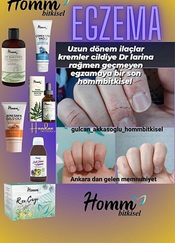 Egzama kremi 