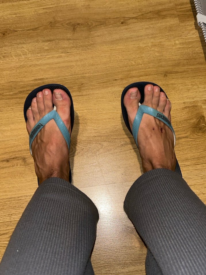 Gri Erkek Bantlı Kauçuk Sandalet - Görsel 2